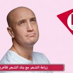 زراعة الشعر مع بنك الشعر للآخرين