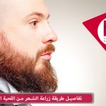 زراعة الشعر من اللحية الى الرأس