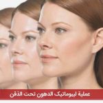 عملیة لیبوماتیک الدهون تحت الذقن
