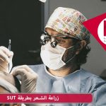 زراعة الشعر بطريقة SUT