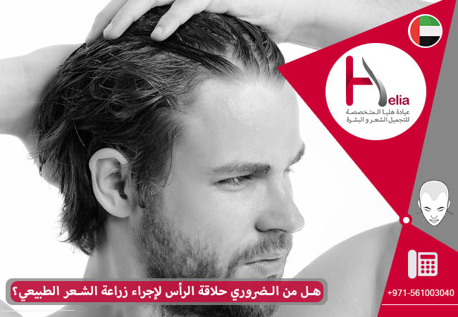 هل من الضروري حلاقة الرأس لإجراء زراعة الشعر؟