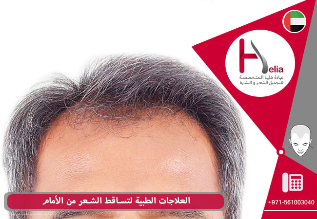 الاسترخاء مرح رائعة  علاج تساقط الشعر في مقدمة الرأس عن طريق زراعة الشعر - عيادة هليا