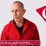 زراعة الشعر الطبيعي عند كبار السن