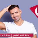 زراعة الشعر في مقدمة الرأس والجبين