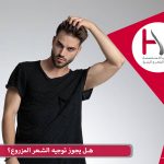 كيفية توجيه الشعر المزروع