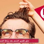 دليل تقصير الشعر بعد زراعة الشعر