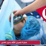 عملية تجميل الأنف بدون تخدير