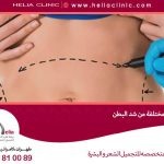 إدخال أنواع مختلفة من شد البطن