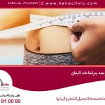 ما مقدار الألم بعد عملية شد البطن؟