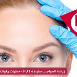 زراعة الحواجب بطريقة FUT - خطوات وفوائد ونقاط مهمة