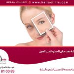 ما هي الرعاية بعد حقن الحشو تحت العين؟