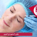 حقن الدهون في الجبين