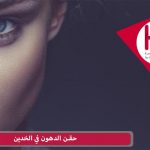حقن الدهون في الخدين