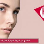 النتيجة النهائية لنقل الدهون