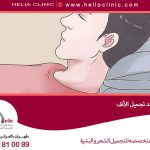 كيف ينام بعد تجميل الأنف