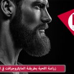 زراعة اللحية بطريقة المايكروجرافت في الإمارات