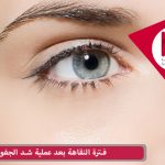 فترة النقاهة بعد عملية شد الجفون