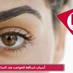 أسباب تساقط الحواجب عند النساء