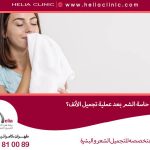 إلى متى يعود حاسة الشم بعد عملية تجميل الأنف؟