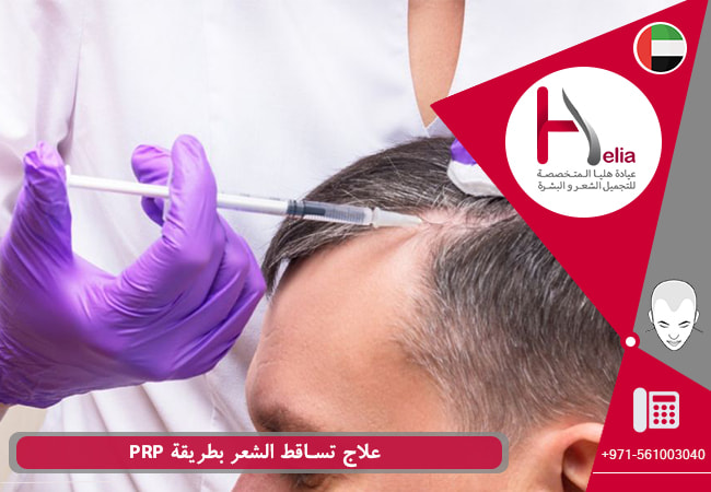 علاج تساقط الشعر بطريقة PRP