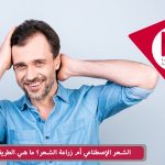 الشعر الإصطناعي أم زراعة الشعر؟ما هي الطريقة الأفضل؟