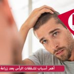 أهم أسباب تشققات الرأس بعد زراعة الشعر