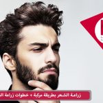 زراعة الشعر بطريقة مركبة