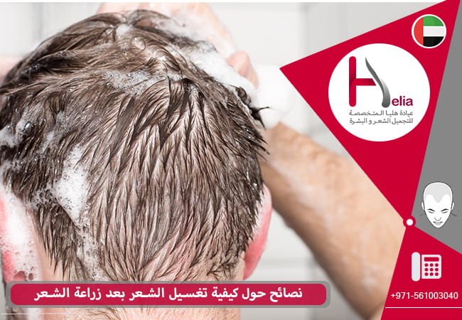 نصائح حول كيفية تغسيل الشعر بعد زراعة الشعر