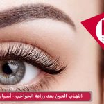 التهاب العين بعد زراعة الحواجب - أسبابه و علاجه
