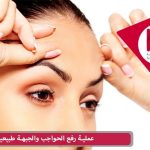 عملية رفع الحواجب والجبهة طبيعياً