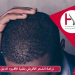 تجربة زراعة الشعر الأفريقي بتقنية الأفرو
