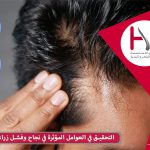 العوامل المؤثرة في نجاح وفشل زراعة الشعر