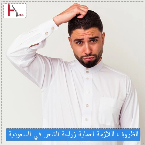 الظروف اللازمة لعملية زراعة الشعر في السعودية