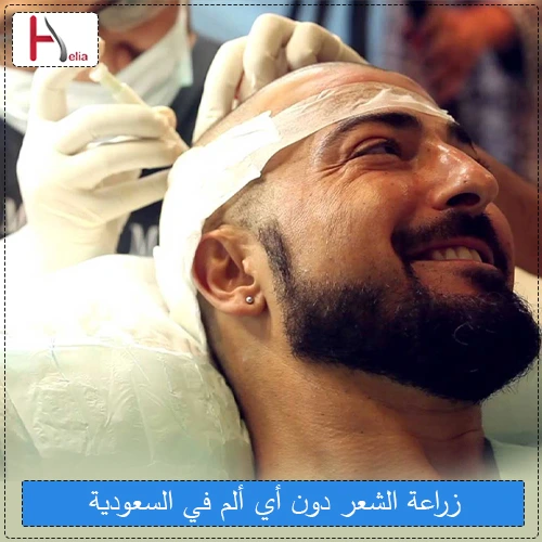 زراعة الشعر بدون ألم في السعودية