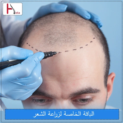 الباقة الخاصة لزراعة الشعر