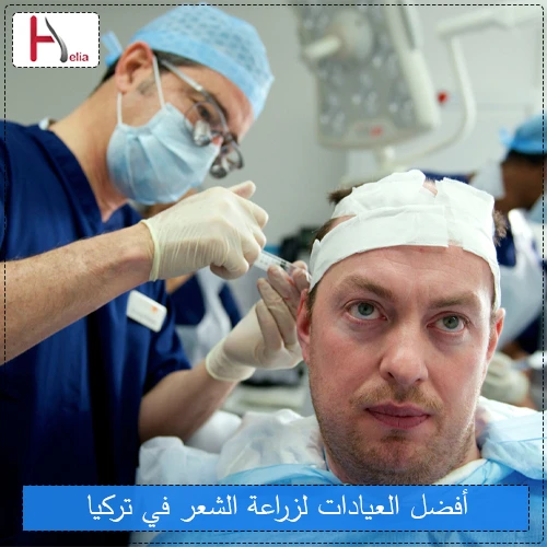 أفضل العيادات لزراعة الشعر في تركيا