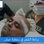 زراعة الشعر في سلطنة عمان