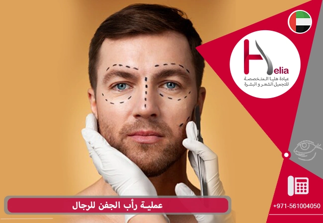 عملیة رأب الجفن للرجال