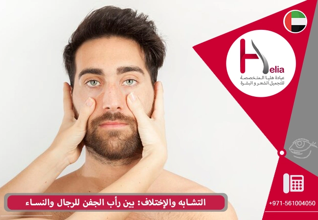 التشابه والإختلاف: بین رأب الجفن للرجال والنساء