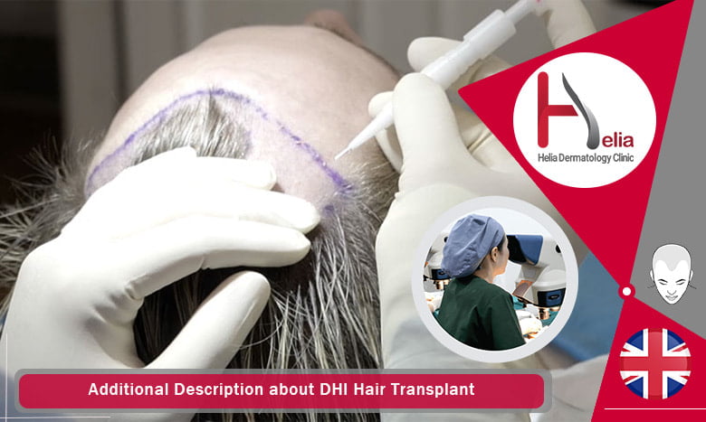 Additional Description about DHI Hair Transplant