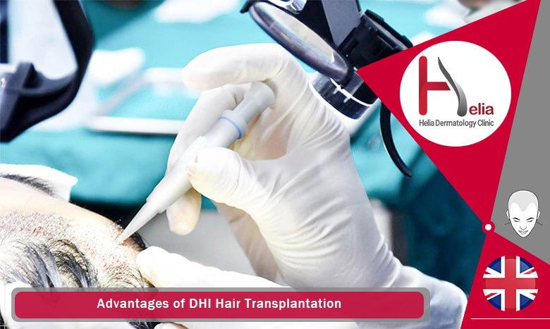 Advantages of DHI Hair Transplantation