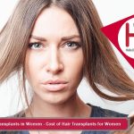 Cost of Hair Transplants for Women