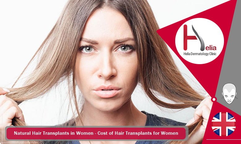Hair Transplants for Women - What Is The Success Rate? - helia dermatology  clinic