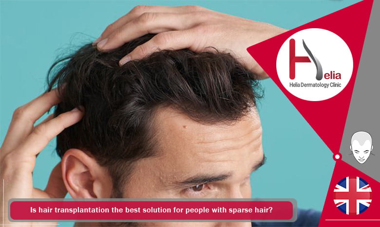 Is hair transplantation the best solution for people with sparse hair?