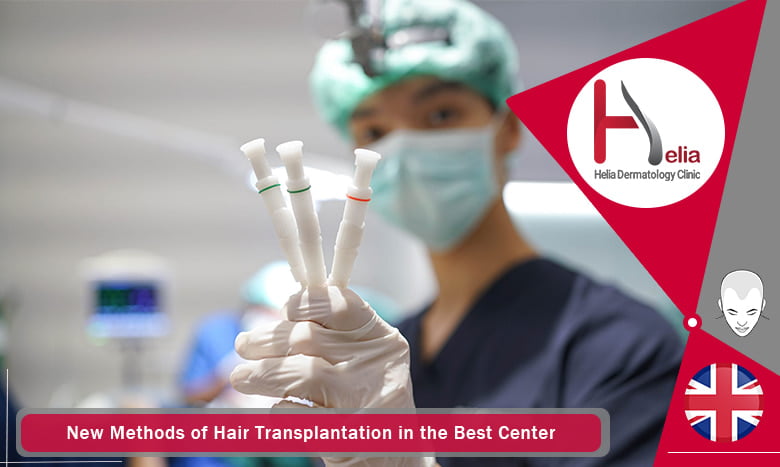 New Methods of Hair Transplantation in the Best Center