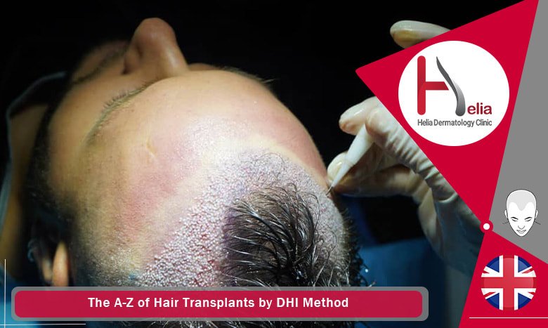 Hair Transplants by DHI Method - helia dermatology clinic