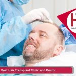 The Best Hair Transplant Clinic and Doctor