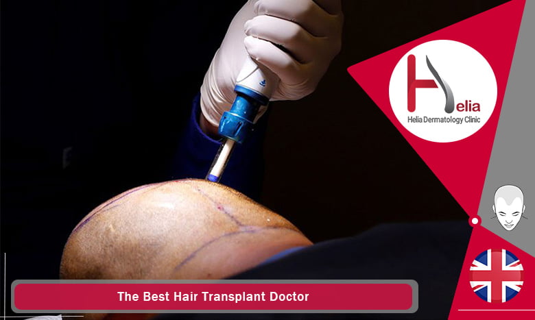 The Best Hair Transplant Doctor