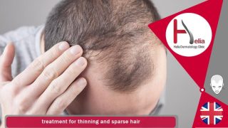 treatment for thinning and sparse hair