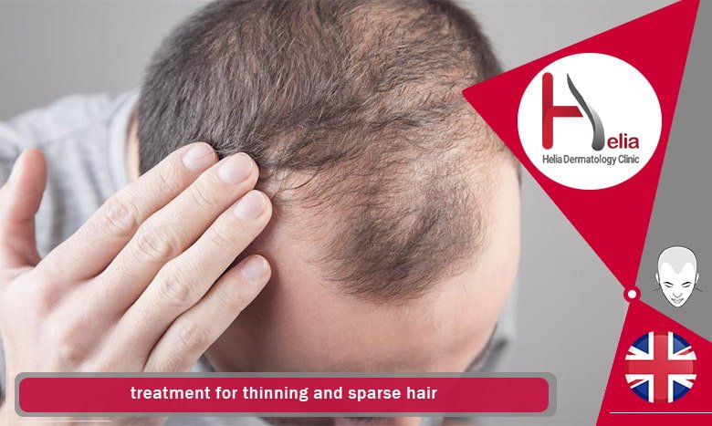 treatment for thinning and sparse hair
